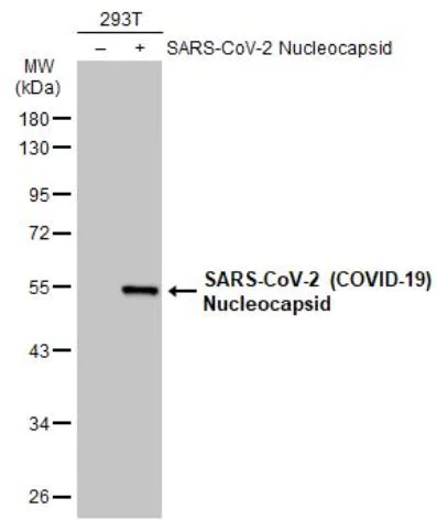 Western blot - Anti-SARS-CoV-2 nucleocapsid protein antibody [HL455-MS] - BSA and Azide free (AB281300)