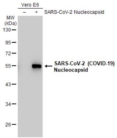 Western blot - Anti-SARS-CoV-2 nucleocapsid protein antibody [HL455-MS] - BSA and Azide free (AB281300), expandable thumbnail