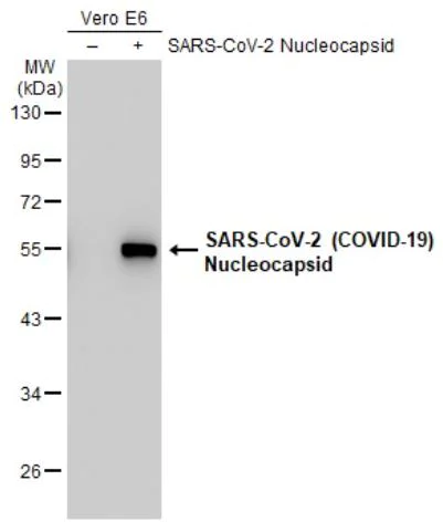 Western blot - Anti-SARS-CoV-2 nucleocapsid protein antibody [HL455-MS] - BSA and Azide free (AB281300)