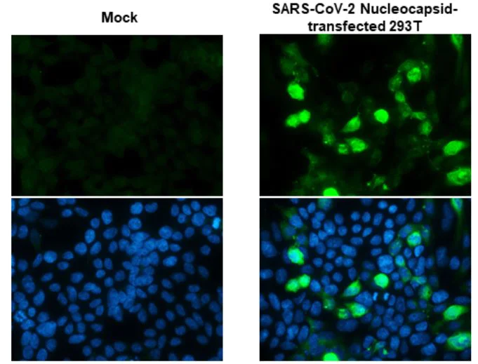 Immunocytochemistry - Anti-SARS-CoV-2 nucleocapsid protein antibody [HL5410] - BSA and Azide free (AB281301)