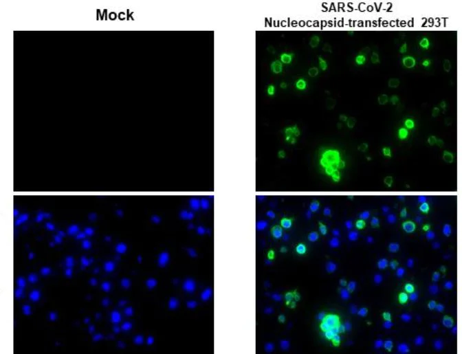 Immunohistochemistry (Formalin/PFA-fixed paraffin-embedded sections) - Anti-SARS-CoV-2 nucleocapsid protein antibody [HL5410] - BSA and Azide free (AB281301)