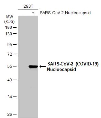 Western blot - Anti-SARS-CoV-2 nucleocapsid protein antibody [HL5410] - BSA and Azide free (AB281301)
