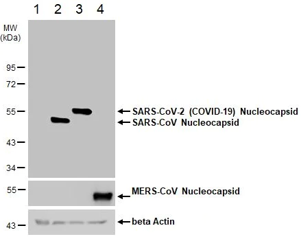 Western blot - Anti-SARS-CoV-2 nucleocapsid protein antibody [HL5410] - BSA and Azide free (AB281301)