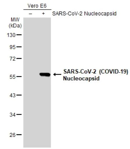 Western blot - Anti-SARS-CoV-2 nucleocapsid protein antibody [HL5410] - BSA and Azide free (AB281301)