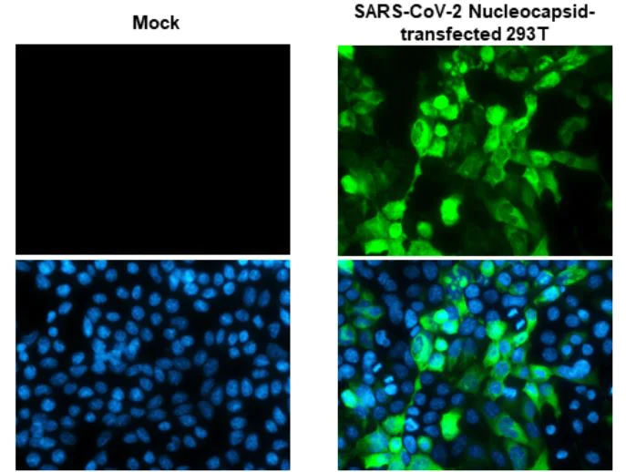 Immunocytochemistry - Anti-SARS-CoV-2 nucleocapsid protein antibody [HL5511] - BSA and Azide free (AB281302)