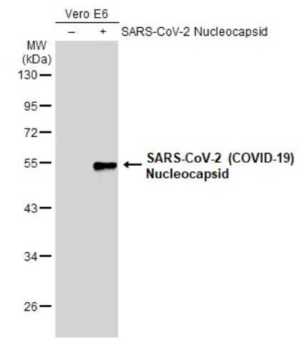 Western blot - Anti-SARS-CoV-2 nucleocapsid protein antibody [HL5511] - BSA and Azide free (AB281302)