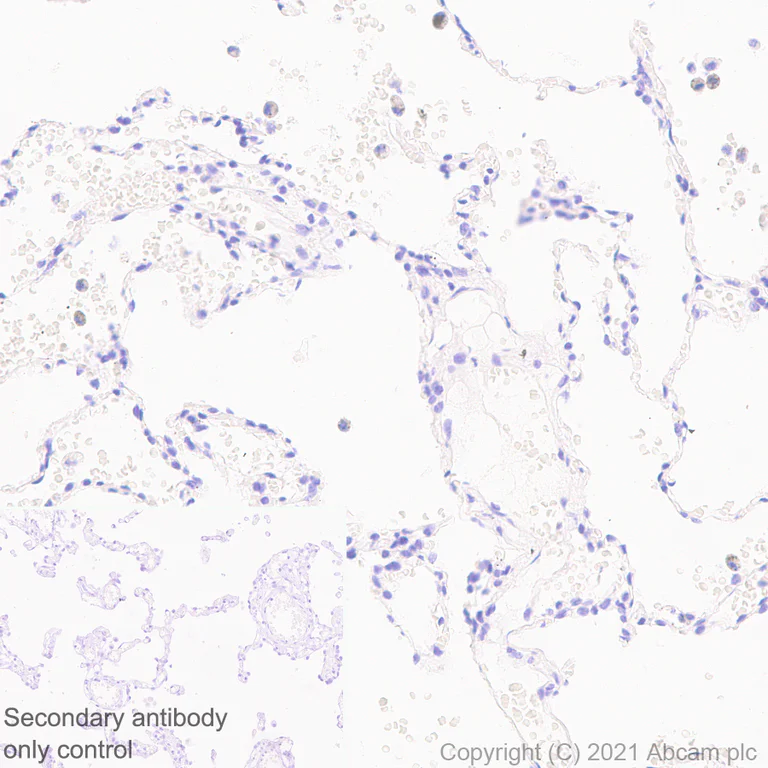 Immunohistochemistry (Formalin/PFA-fixed paraffin-embedded sections) - Anti-SARS CoV-2 ORF3a Protein antibody [EPR24848-9] - BSA and Azide free (AB280961)