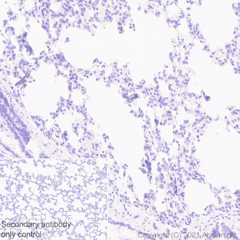 Immunohistochemistry (Formalin/PFA-fixed paraffin-embedded sections) - Anti-SARS CoV-2 ORF3a Protein antibody [EPR24848-9] - BSA and Azide free (AB280961)