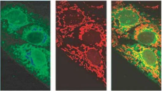Immunocytochemistry/ Immunofluorescence - Anti-SARS-CoV-2 orf7a antibody [3C9] (AB273435)