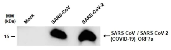 Western blot - Anti-SARS-CoV-2 orf7a antibody [3C9] (AB273435)