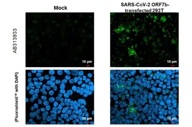 Immunocytochemistry/ Immunofluorescence - Anti-SARS-CoV-2 ORF7b antibody [HL1453] - BSA and Azide free (AB313933), expandable thumbnail