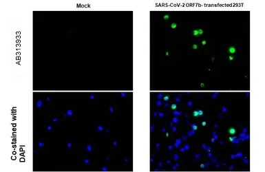 Immunohistochemistry (Formalin/PFA-fixed paraffin-embedded sections) - Anti-SARS-CoV-2 ORF7b antibody [HL1453] - BSA and Azide free (AB313933), expandable thumbnail