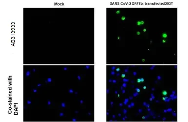 Immunohistochemistry (Formalin/PFA-fixed paraffin-embedded sections) - Anti-SARS-CoV-2 ORF7b antibody [HL1453] - BSA and Azide free (AB313933)