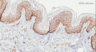 Immunohistochemistry (Formalin/PFA-fixed paraffin-embedded sections) - Anti-SARS-CoV-2 spike glycoprotein antibody - Coronavirus (AB272504)