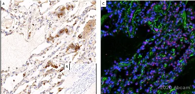 Immunohistochemistry (Formalin/PFA-fixed paraffin-embedded sections) - Anti-SARS-CoV-2 spike glycoprotein antibody - Coronavirus (AB272504)