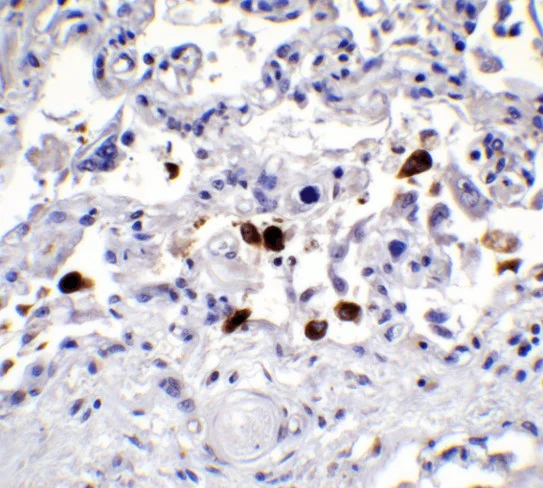 Immunohistochemistry (Formalin/PFA-fixed paraffin-embedded sections) - Anti-SARS-CoV-2 spike glycoprotein antibody - Coronavirus (AB272504)