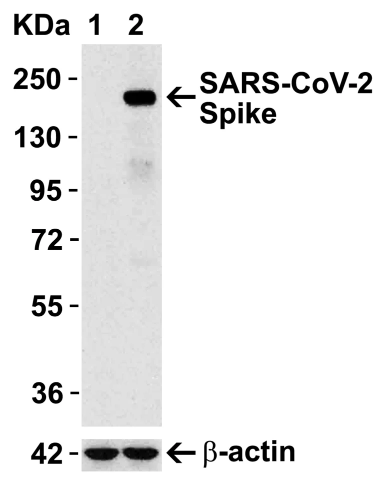 Western blot - Anti-SARS-CoV-2 spike glycoprotein antibody - Coronavirus (AB272504)