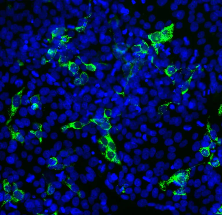 Immunocytochemistry/ Immunofluorescence - Anti-SARS-CoV-2 Spike Glycoprotein RBD antibody [2G1] (AB277624)