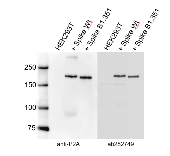 Western blot - Anti-SARS-CoV-2 Spike Glycoprotein S1 antibody [8B12-C2] - BSA and Azide free (AB282749)