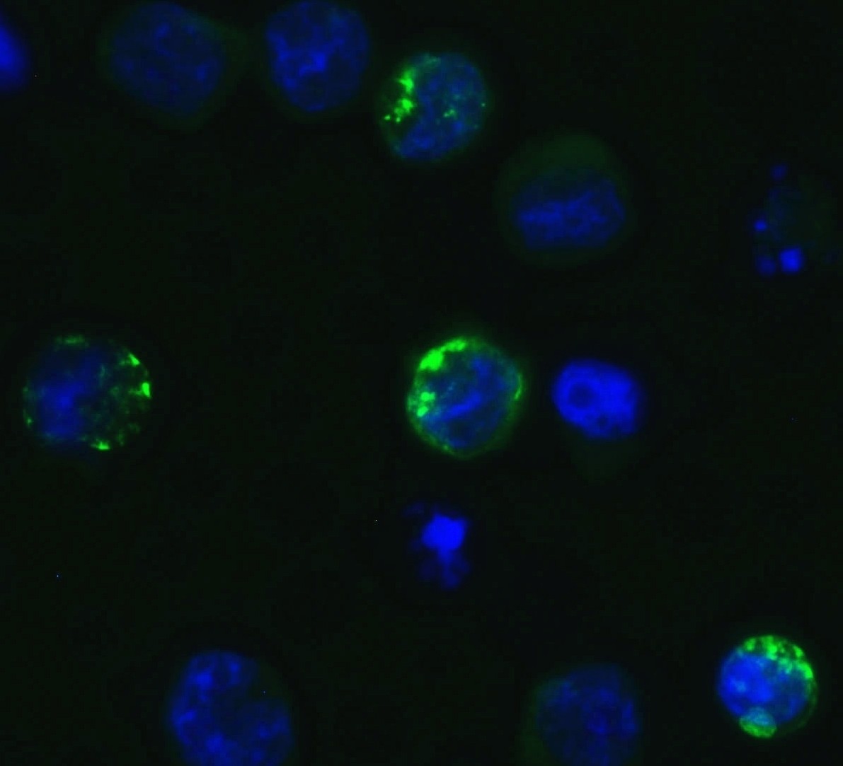 Anti-SARS-CoV-2 Spike Glycoprotein S1 antibody (ab275759) | Abcam