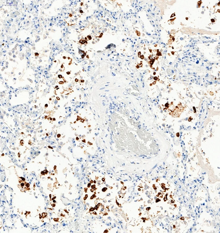 Immunohistochemistry (Formalin/PFA-fixed paraffin-embedded sections) - Anti-SARS-CoV-2 Spike Glycoprotein S1 antibody (AB275759)