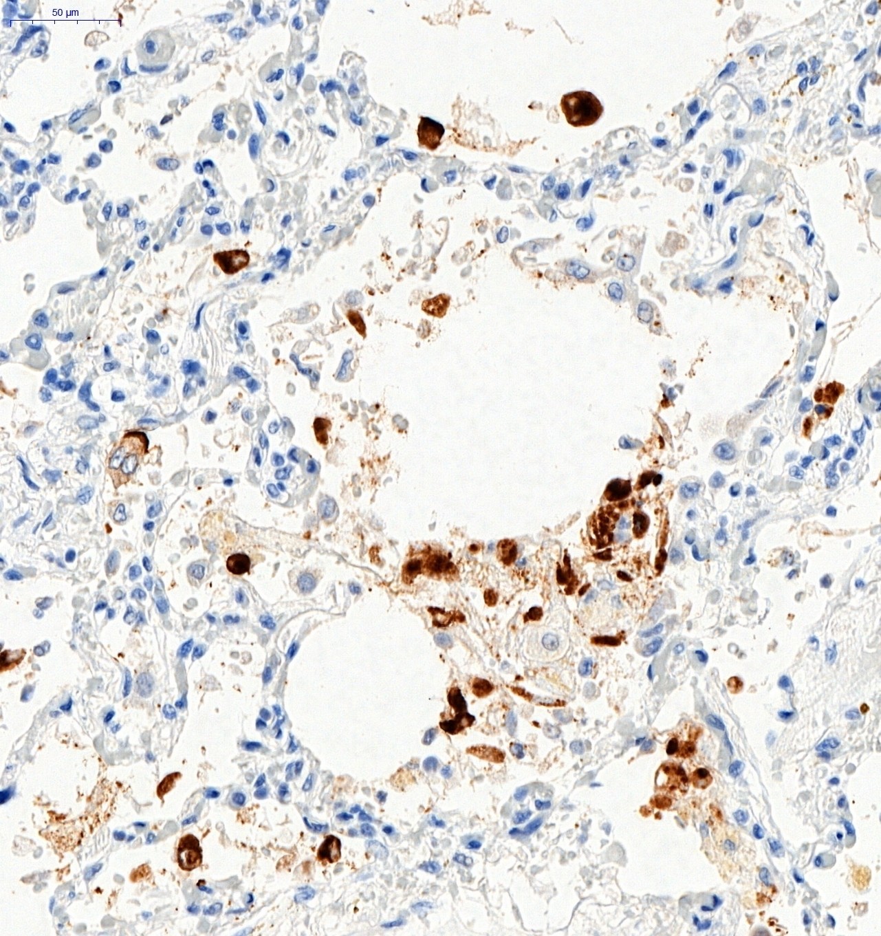 Anti-SARS-CoV-2 Spike Glycoprotein S1 antibody (ab275759) | Abcam