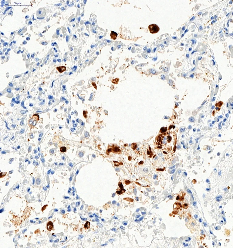 Immunohistochemistry (Formalin/PFA-fixed paraffin-embedded sections) - Anti-SARS-CoV-2 Spike Glycoprotein S1 antibody (AB275759)