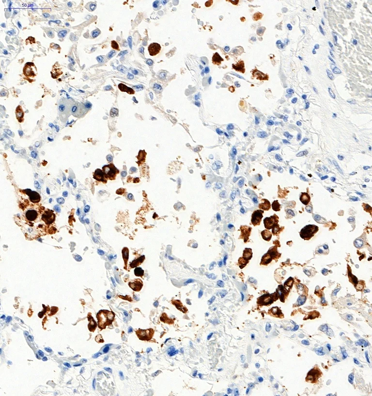 Immunohistochemistry (Formalin/PFA-fixed paraffin-embedded sections) - Anti-SARS-CoV-2 Spike Glycoprotein S1 antibody (AB275759)