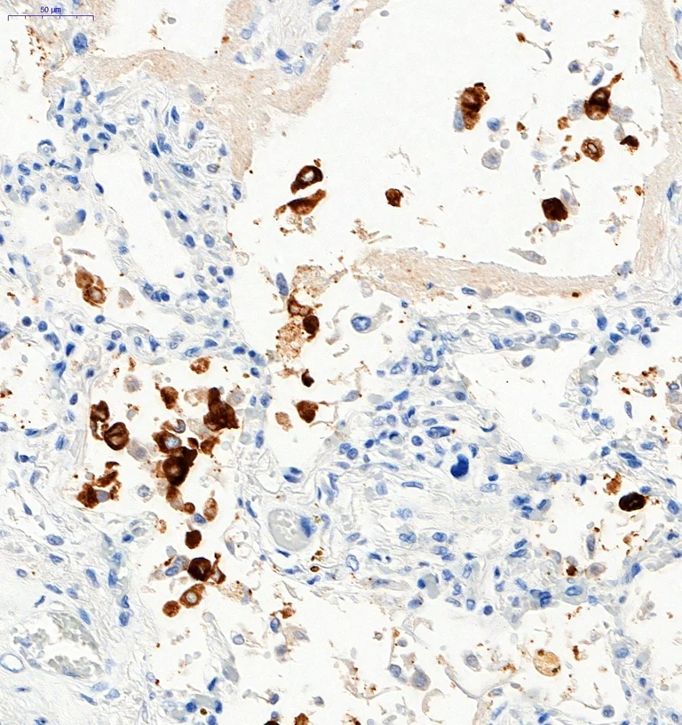 Immunohistochemistry (Formalin/PFA-fixed paraffin-embedded sections) - Anti-SARS-CoV-2 Spike Glycoprotein S1 antibody (AB275759)