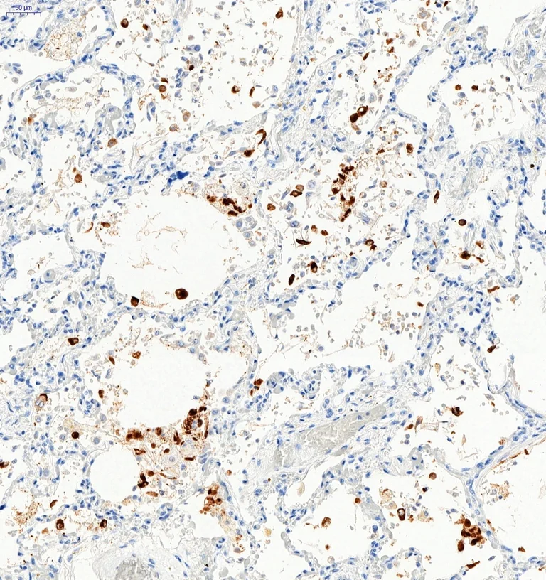 Immunohistochemistry (Formalin/PFA-fixed paraffin-embedded sections) - Anti-SARS-CoV-2 Spike Glycoprotein S1 antibody (AB275759)