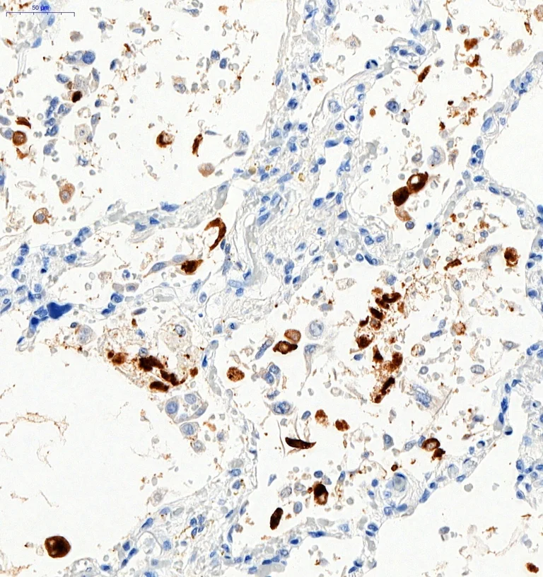 Immunohistochemistry (Formalin/PFA-fixed paraffin-embedded sections) - Anti-SARS-CoV-2 Spike Glycoprotein S1 antibody (AB275759)