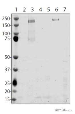 Western blot - Anti-SARS-CoV-2 Spike Glycoprotein S1 antibody [EPR24852-116] (AB283942)