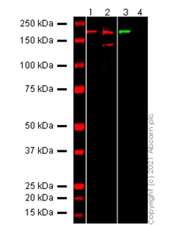 Western blot - Anti-SARS-CoV-2 Spike Glycoprotein S1 antibody [EPR24852-116] - BSA and Azide free (AB283943)