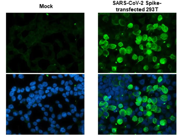 Immunocytochemistry - Anti-SARS-CoV-2 Spike Glycoprotein S1 antibody [HL1] - BSA and Azide free (AB281307)