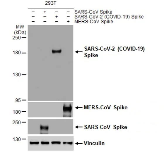 Western blot - Anti-SARS-CoV-2 Spike Glycoprotein S1 antibody [HL1] - BSA and Azide free (AB281307)