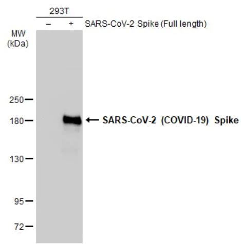 Western blot - Anti-SARS-CoV-2 Spike Glycoprotein S1 antibody [HL1] - BSA and Azide free (AB281307)