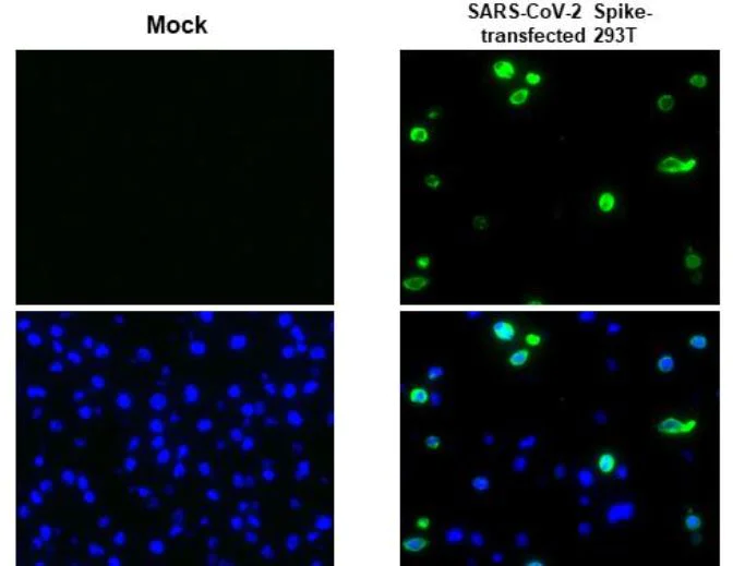 Immunohistochemistry (Formalin/PFA-fixed paraffin-embedded sections) - Anti-SARS-CoV-2 Spike Glycoprotein S1 antibody [HL134] - BSA and Azide free (AB281308)