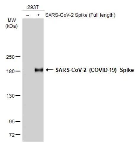 Western blot - Anti-SARS-CoV-2 Spike Glycoprotein S1 antibody [HL134] - BSA and Azide free (AB281308)