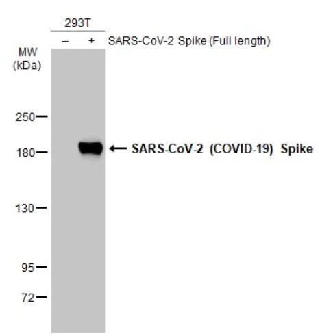 Western blot - Anti-SARS-CoV-2 Spike Glycoprotein S1 antibody [HL13402] - BSA and Azide free (AB281309)