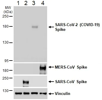 Western blot - Anti-SARS-CoV-2 Spike Glycoprotein S1 antibody [HL13402] - BSA and Azide free (AB281309)