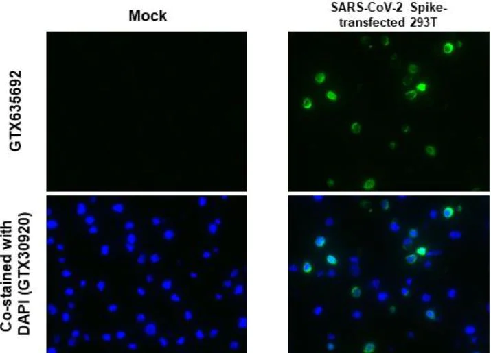 Immunocytochemistry - Anti-SARS-CoV-2 Spike Glycoprotein S1 antibody [HL257] - BSA and Azide free (AB281306)