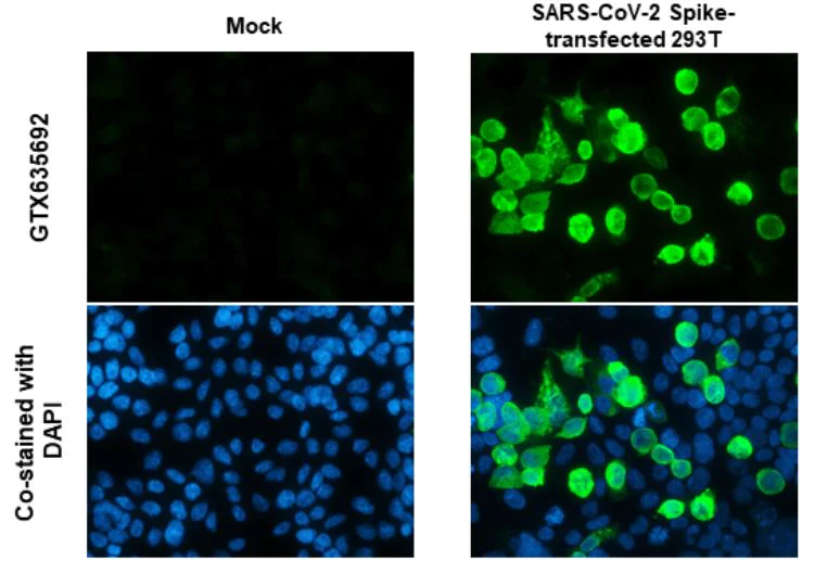 Immunocytochemistry - Anti-SARS-CoV-2 Spike Glycoprotein S1 antibody [HL257] - BSA and Azide free (AB281306)