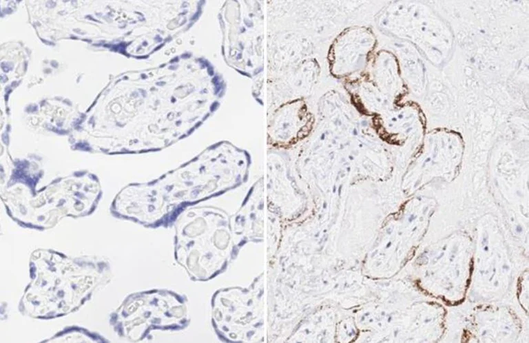 Immunohistochemistry (Formalin/PFA-fixed paraffin-embedded sections) - Anti-SARS-CoV-2 Spike Glycoprotein S1 antibody [HL257] - BSA and Azide free (AB281306)