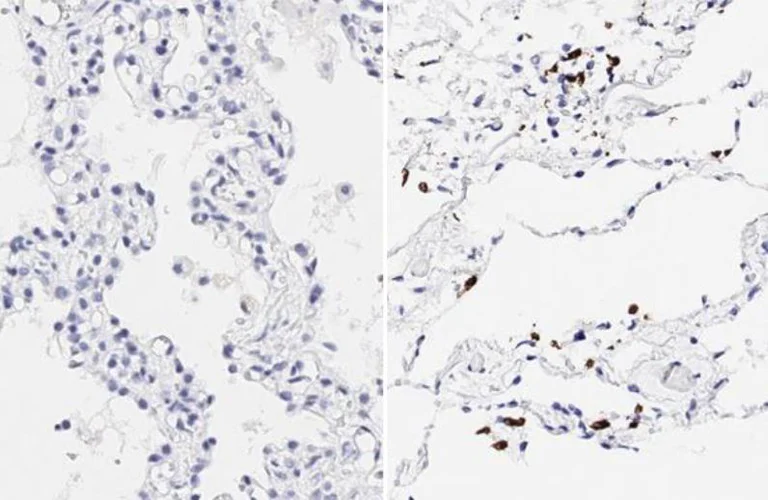 Immunohistochemistry (Formalin/PFA-fixed paraffin-embedded sections) - Anti-SARS-CoV-2 Spike Glycoprotein S1 antibody [HL257] - BSA and Azide free (AB281306)