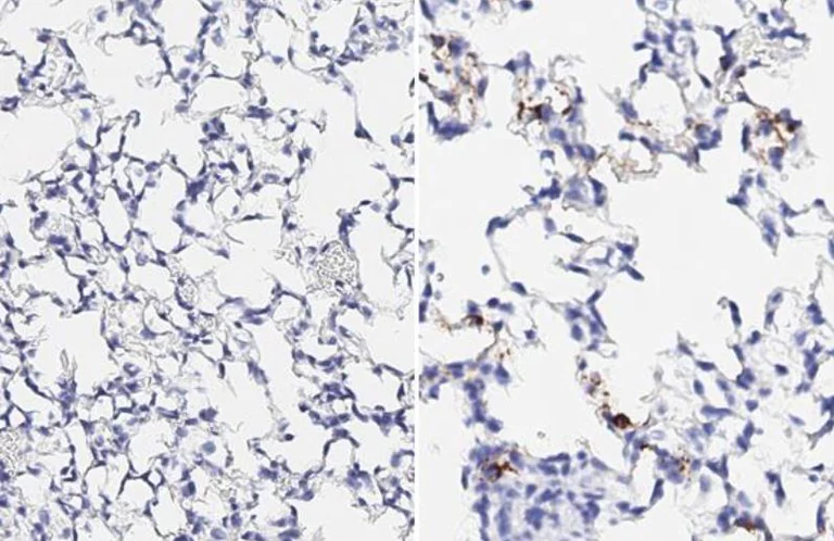 Immunohistochemistry (Formalin/PFA-fixed paraffin-embedded sections) - Anti-SARS-CoV-2 Spike Glycoprotein S1 antibody [HL257] - BSA and Azide free (AB281306)