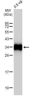 Western blot - Anti-SARS-CoV-2 Spike Glycoprotein S1 antibody [HL257] - BSA and Azide free (AB281306)