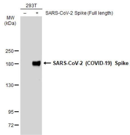 Western blot - Anti-SARS-CoV-2 Spike Glycoprotein S1 antibody [HL257] - BSA and Azide free (AB281306)