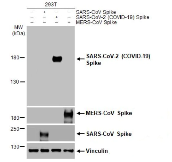 Western blot - Anti-SARS-CoV-2 Spike Glycoprotein S1 antibody [HL257] - BSA and Azide free (AB281306)