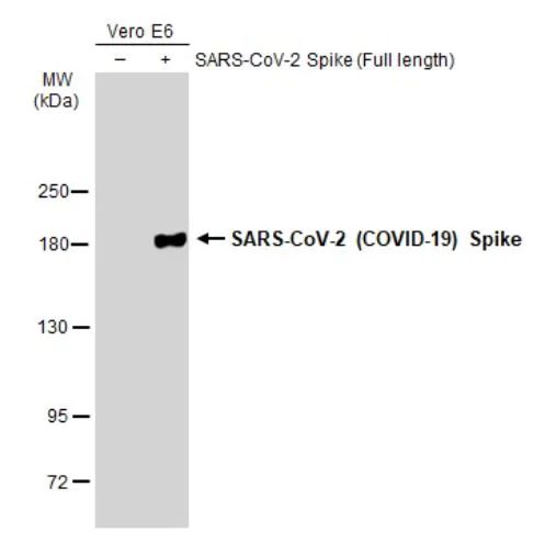 Western blot - Anti-SARS-CoV-2 Spike Glycoprotein S1 antibody [HL257] - BSA and Azide free (AB281306)
