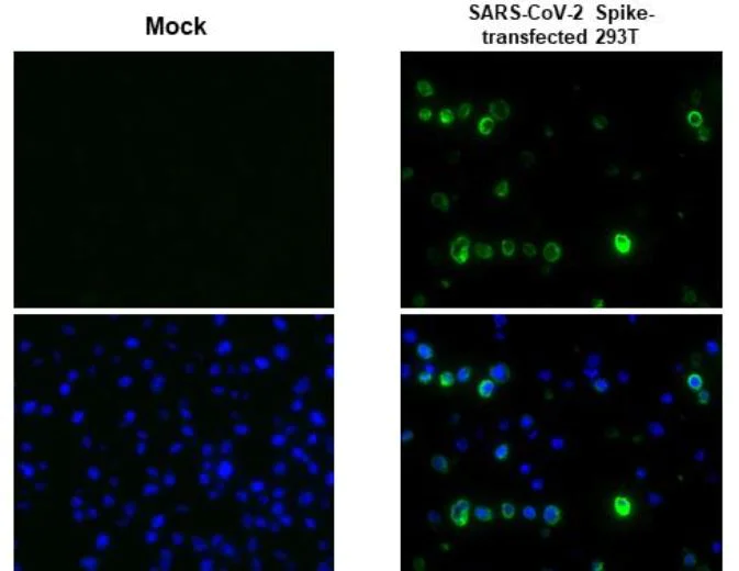 Immunohistochemistry (Formalin/PFA-fixed paraffin-embedded sections) - Anti-SARS-CoV-2 Spike Glycoprotein S1 antibody [HL263] - BSA and Azide free (AB281310)